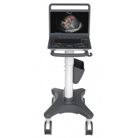 Ultrasonograf SonoScape E2