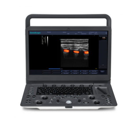 Ultrasonograf SonoScape E2
